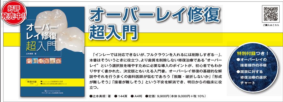 オーバーレイ修復”のステップや 勘所をビジュアルに解説した1冊