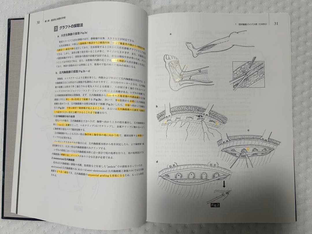 心臓血管外科手術書 磯村 - メルカリ